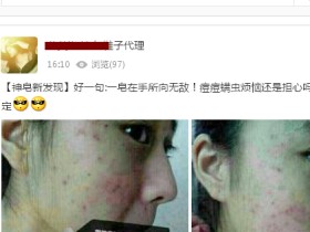 社交媒体网络成为广告泛滥的平台——你被困扰了吗